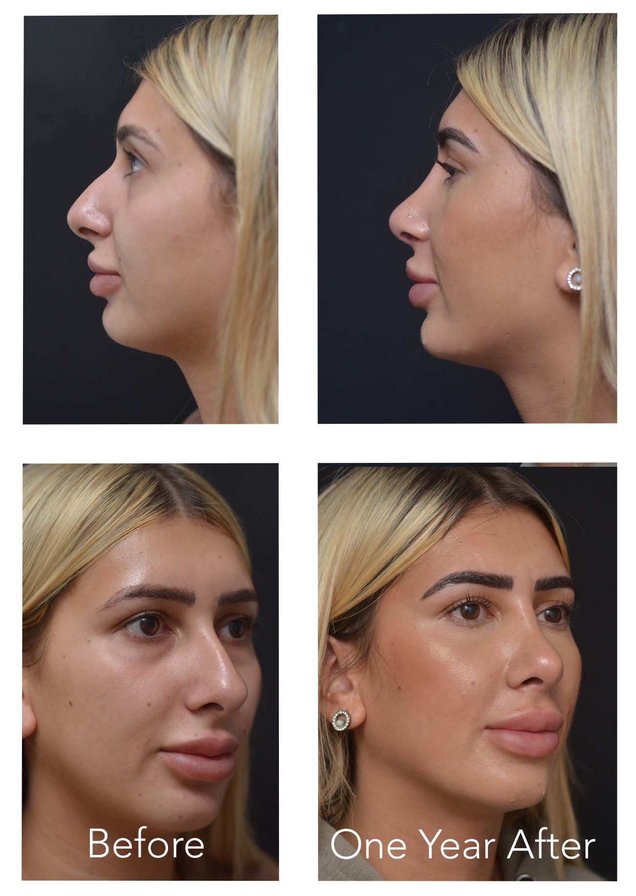 B WEBSITE